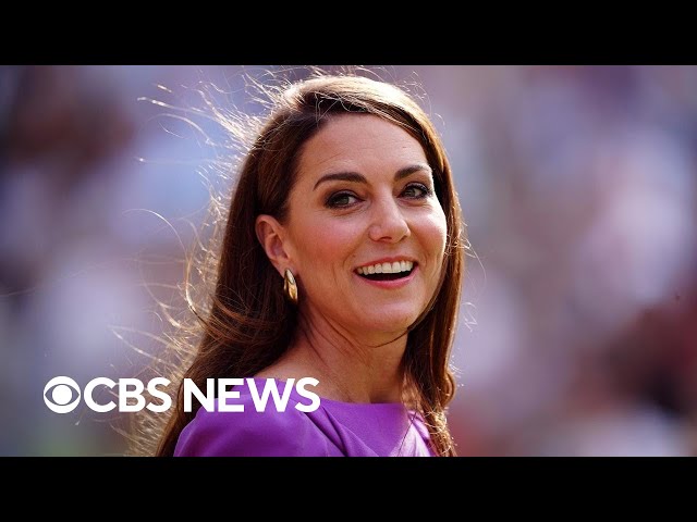 ⁣What's next for Kate Middleton after finishing chemotherapy?