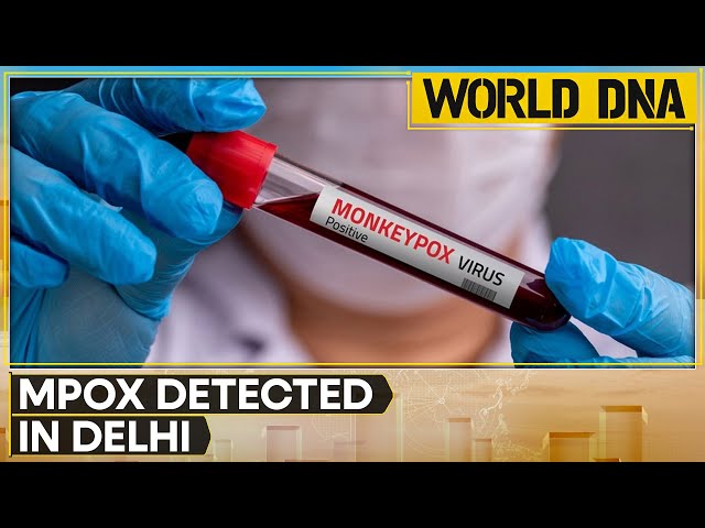 ⁣India reports first suspected case of Mpox | Latest English News | WION World DNA