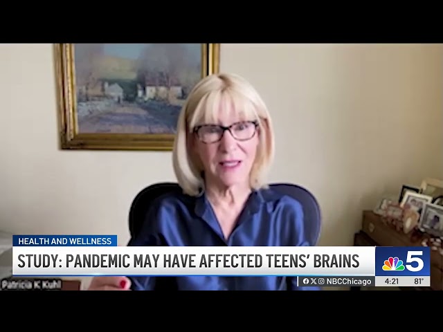 ⁣Study: Pandemic may have prematurely aged teens' brains