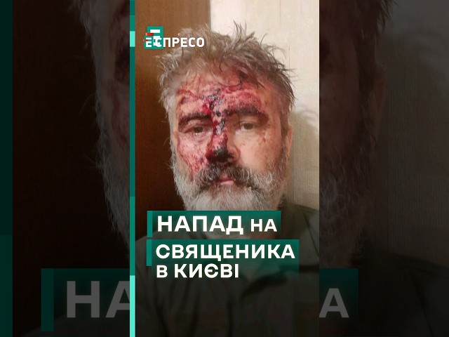 ⁣ Цинічний напад на Митрополита Кримського Климента, який служить в ЗСУ! #еспресо #новини #блог