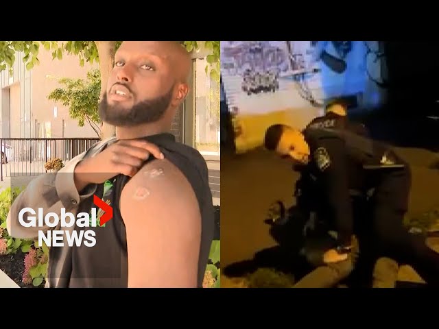 ⁣"I can’t breathe": Ontario man accuses police in Quebec of using excessive force