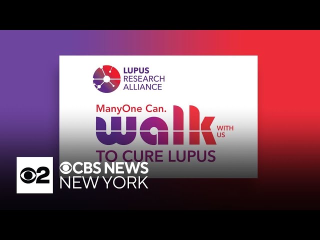 ⁣Walk with us to cure Lupus