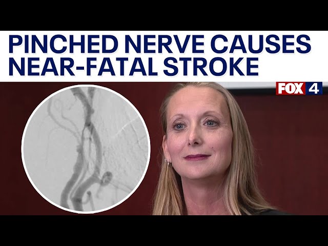 ⁣North Texas woman has near-fatal stroke after chiropractor visit, doctor says