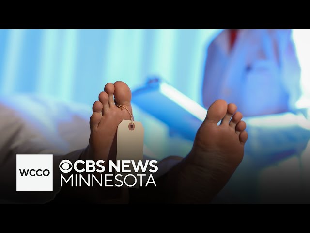 ⁣More cases may be overturned due to Ramsey County Medical Examiner