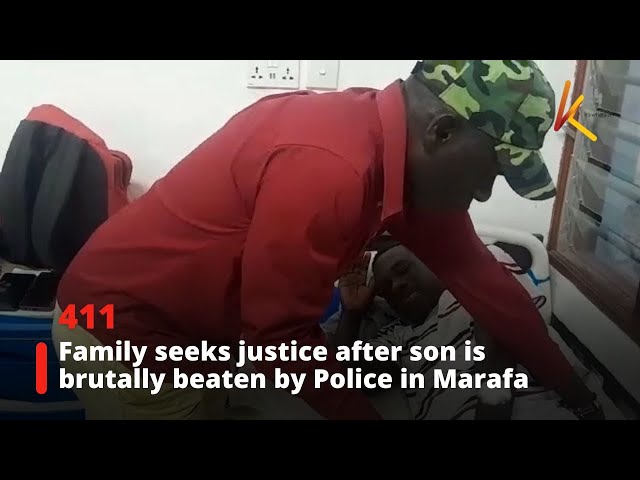 ⁣Family seeks justice after son is brutally beaten by Police in Marafa