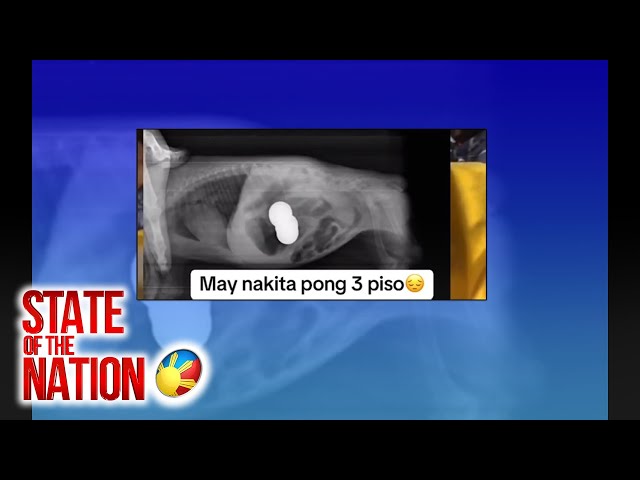 ⁣Tuta, nakalunok ng mga barya; nagkaimpeksyon at namatay  | SONA