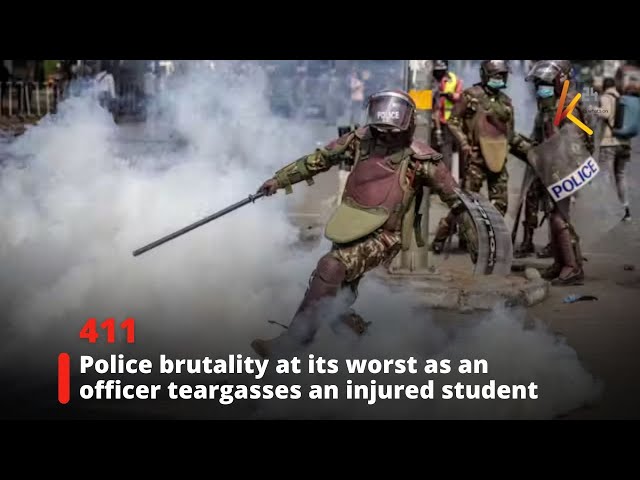 ⁣Police brutality at its worst as an officer teargasses an injured student