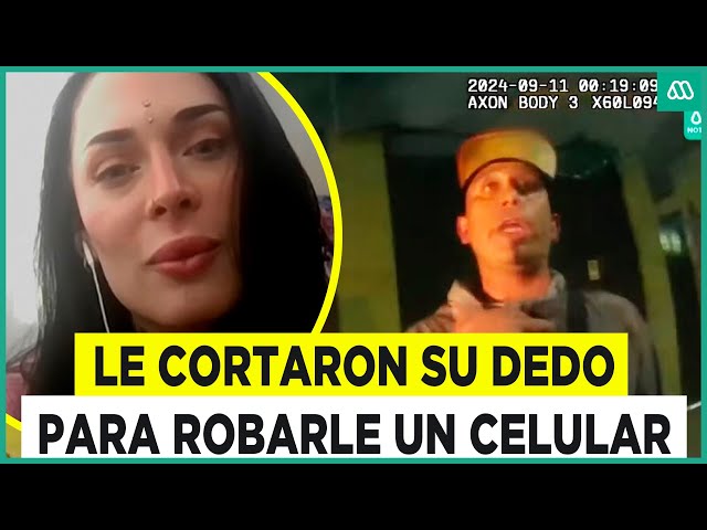 Le cortaron su dedo: Dos asaltantes apuñalan a joven para robarle su celular