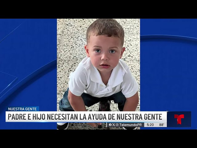 ⁣Piden ayuda para padre y bebé que sufrieron graves quemaduras_copy