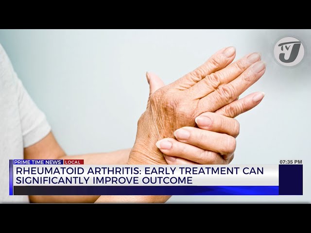 ⁣Rheumatoid Arthritis: Early Treatment Can Significantly Improve Outcome | TVJ News