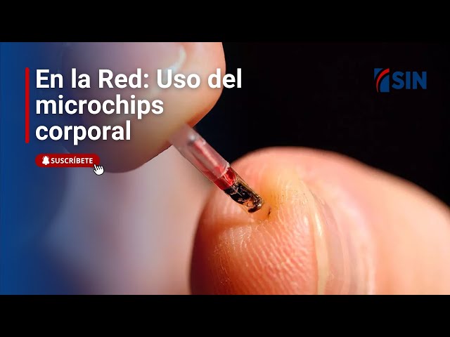 ⁣En la Red: El uso del microchips corporal