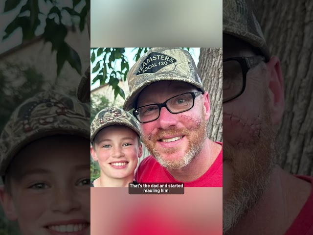 ⁣12-year-old Wisconsin boy saves father’s life from bear attack