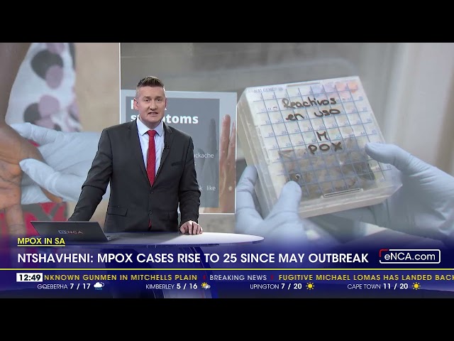 ⁣Mpox In SA | Mpox cases rise to 25 since May outbreak