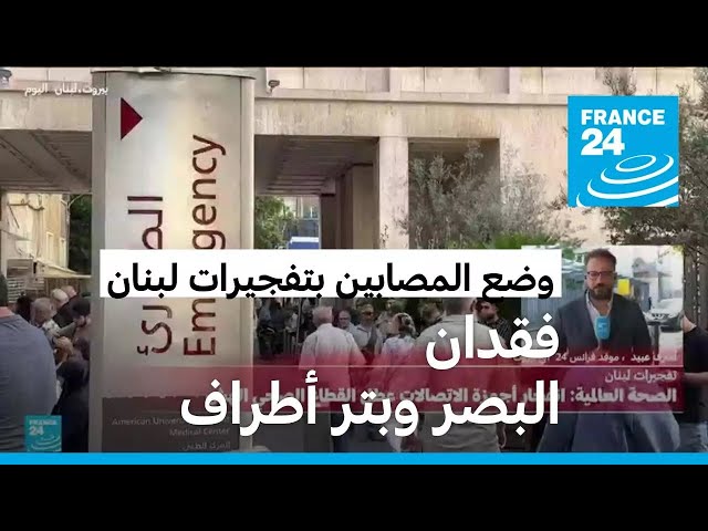 ⁣أكثر من 3 آلاف مصاب بتفجيرات لبنان: نحو 300 منهم فقدوا البصر كليا و500 فقدوا عينا