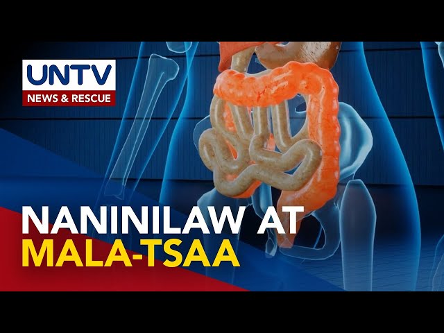 ⁣ALAMIN: Paninilaw ng balat at kulay-tsaa na ihi, senyales ng malubhang sakit sa lapay | DoTV