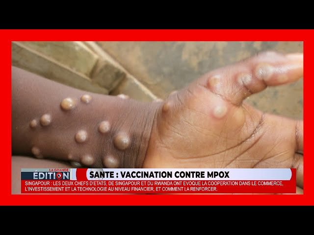 ⁣Le Rwanda débute la vaccination contre Mpox