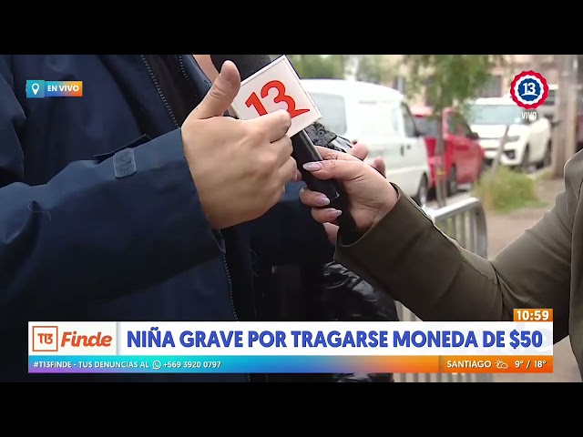 Niña de seis años grave tras tragarse moneda de $50