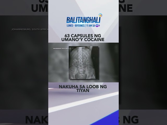 ⁣63 capsules ng umano'y cocaine, nakuha sa loob ng tiyan ng isang drug mule #shorts | Balitangha