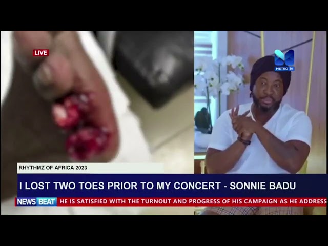 ⁣I lost two toes prior to my concert --- Sonnie Badu