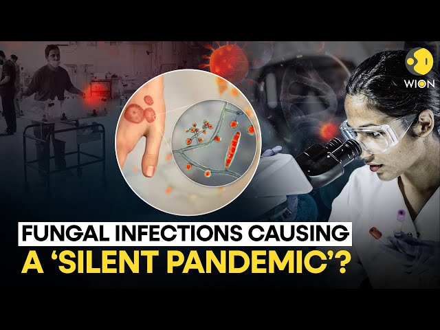 Scientists warn deadly fungal infections are causing a 'silent pandemic' | WION Originals