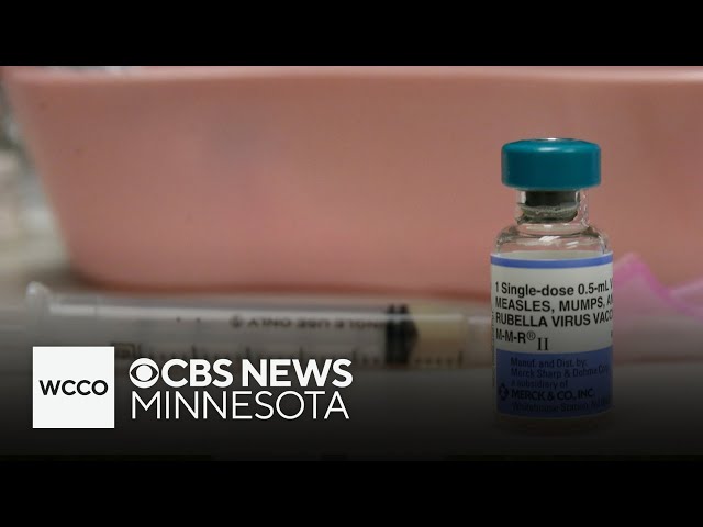 ⁣Minnesota Department of Health looks to get a handle on measles outbreak