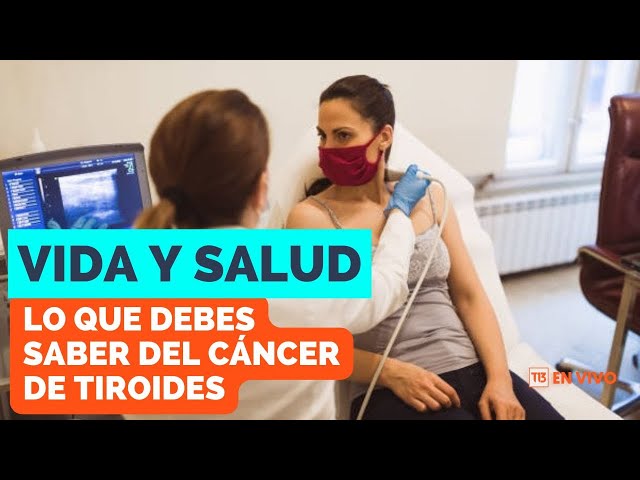 Vida y Salud: Todo lo que debes saber del cáncer de tiroides