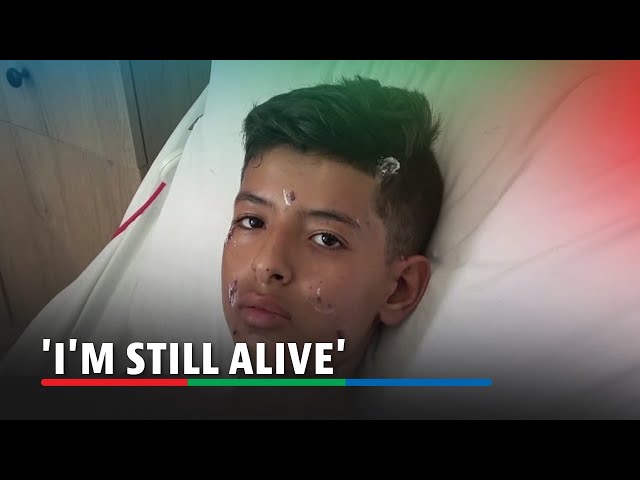 ⁣'I'm still alive,' says wounded boy after Israeli strikes in Lebanon