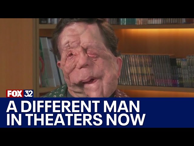 'A Different Man' now playing in theaters