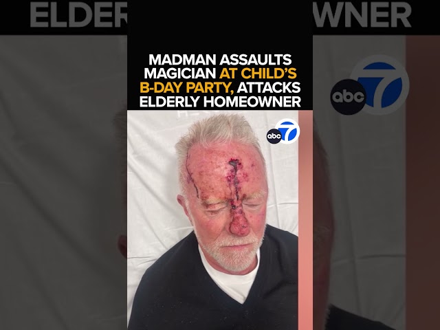 ⁣Man arrested in string of shocking attacks in Pacific Palisades