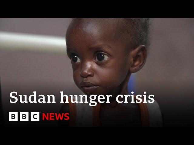 ⁣Inside the hospital dealing with Sudan's famine | BBC News