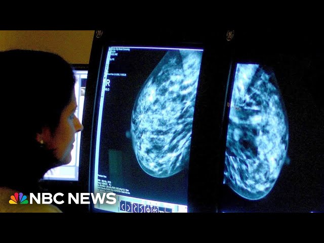 ⁣American Cancer Society report finds rise in breast cancer cases in younger women