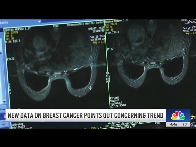 ⁣New data on breast cancer points out concerning trend