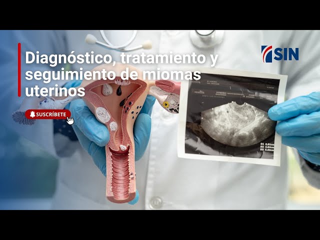 ⁣Diagnóstico, tratamiento y seguimiento de miomas uterinos