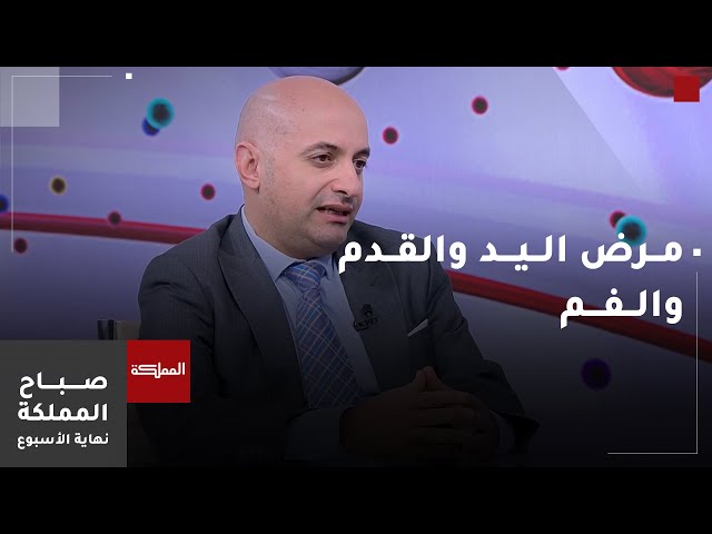 ⁣صباح المملكة نهاية الأسبوع | مرض اليد والقدم والفم.. أعراضه وأسبابه وطرق الوقاية منه