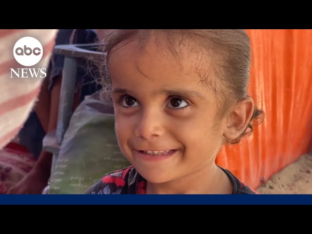 ⁣Gaza's silent crisis: A child's battle against malnutrition