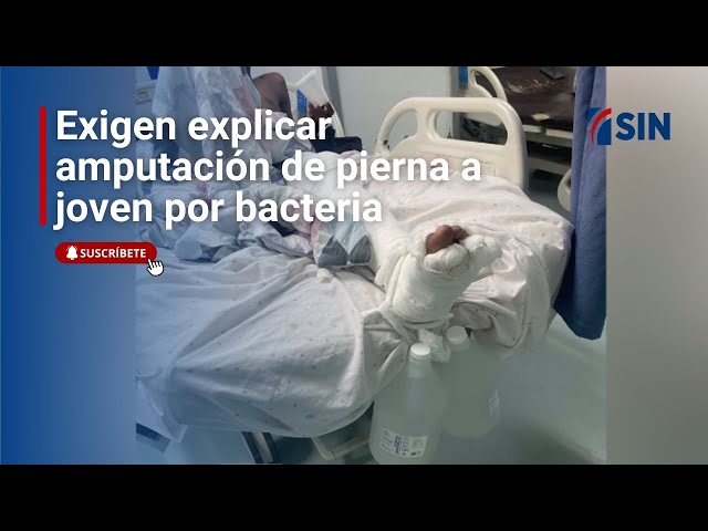 ⁣Exigen explicar amputación de pierna a joven por bacteria