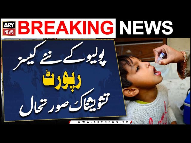 ⁣Polio ke naye cases report, tashweeshnak surat e haal