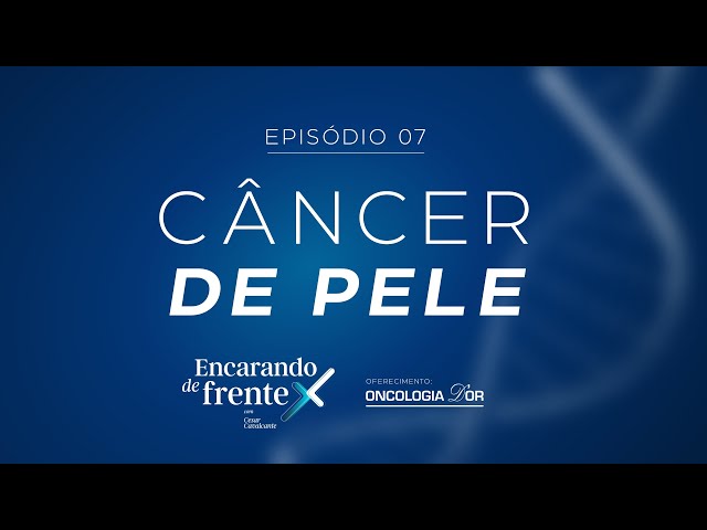 ⁣Câncer de pele | Encarando de Frente