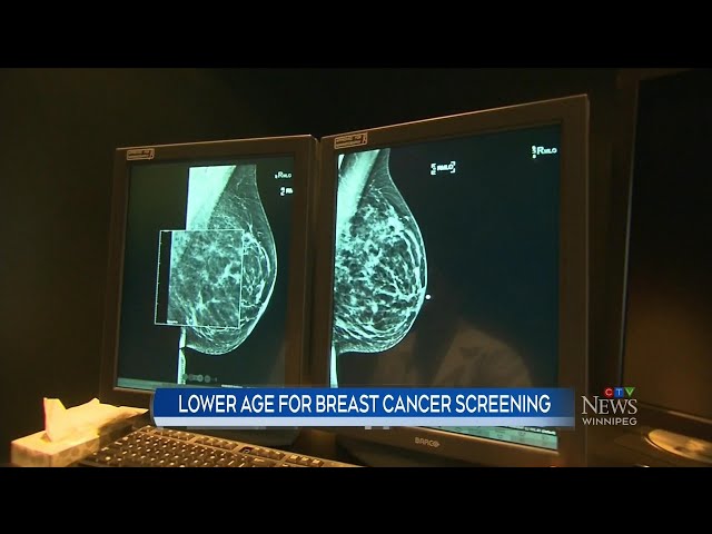 ⁣Manitoba announces plan to lower age for breast cancer screening