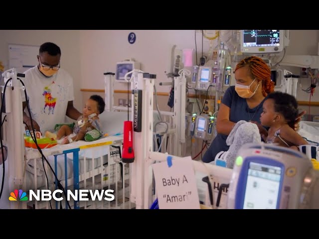 ⁣Surgeons in Philadelphia successfully separate conjoined twins