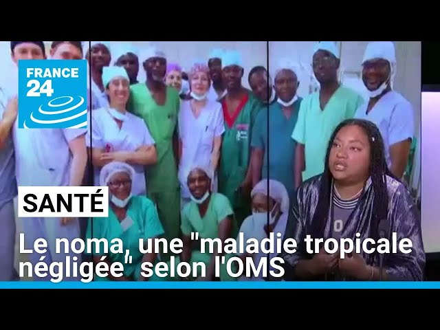 ⁣Le noma, une "maladie tropicale négligée" selon l'OMS • FRANCE 24