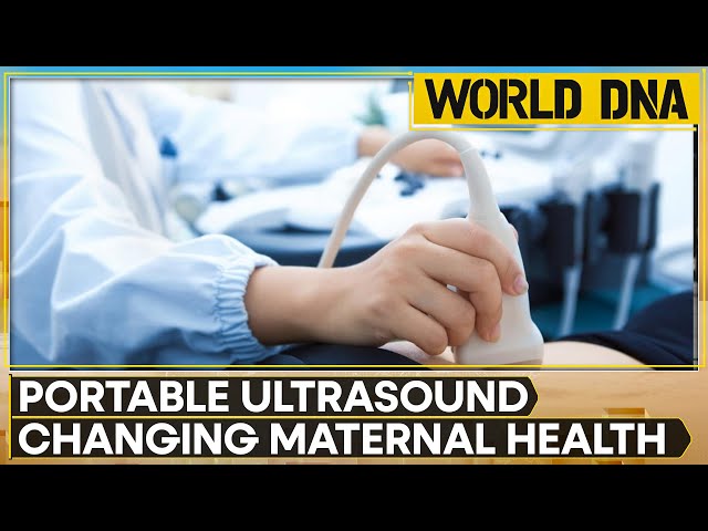 ⁣Portable Ultrasound Devices Bring Life-Saving Care To Kenya's Remote Villages | World DNA | WIO