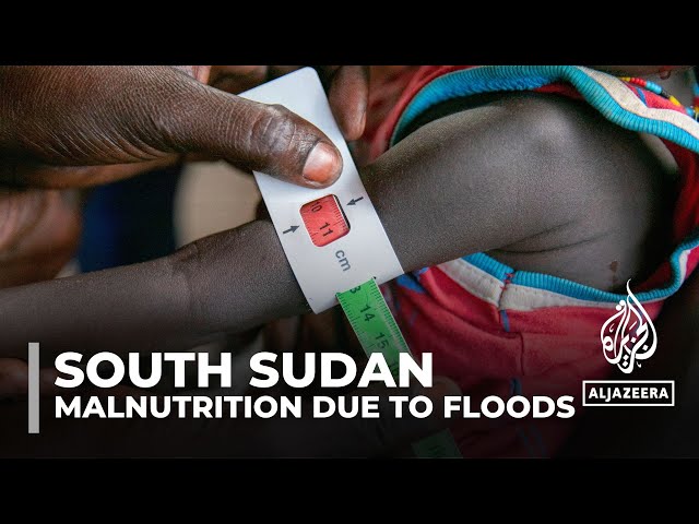 ⁣South Sudan floods: Over one million children at risk of malnutrition