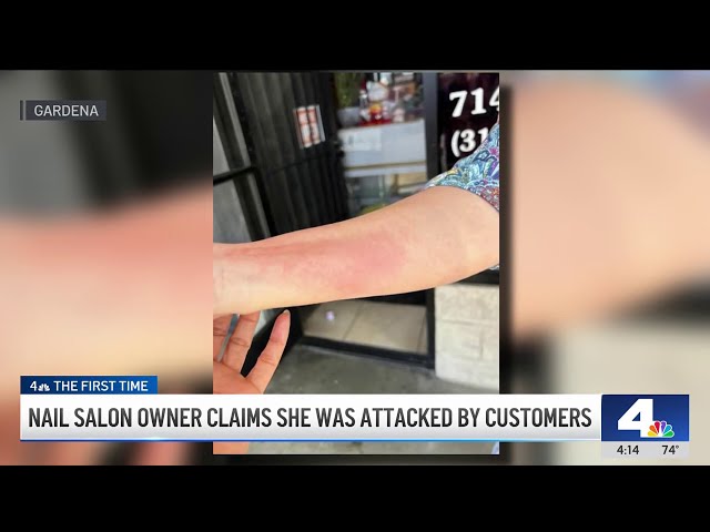 ⁣Gardena nail salon owner assaulted by customers