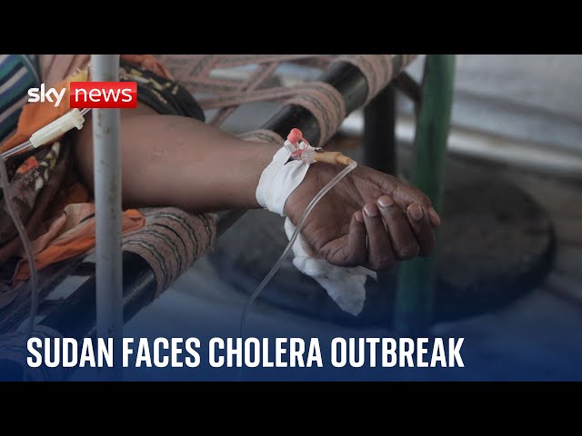 ⁣Sudan: Over 20,000 cases of Cholera disease in war-hit country