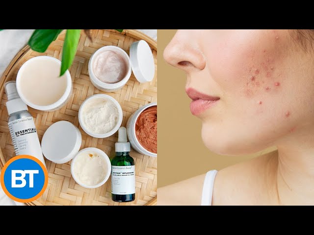 ⁣These are the dos-and-don’ts when it comes to acne problems