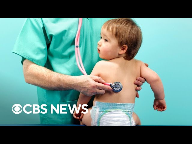 ⁣CDC warns whooping cough cases are on the rise