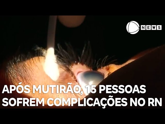 ⁣15 pessoas sofrem complicações após mutirão no Rio Grande do Norte