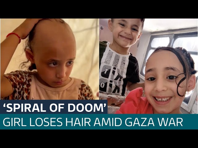 ⁣'Spiral of doom': Girl, 8, loses hair amid Israel's bombardment of Gaza | ITV News