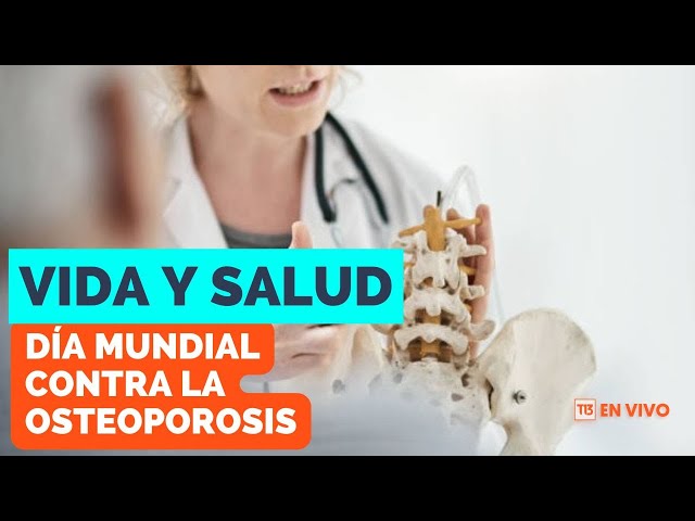 ⁣Vida y Salud: Día Mundial contra la Osteoporosis